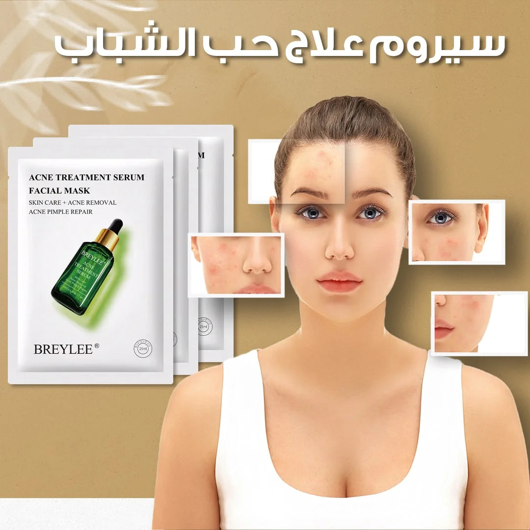 Acne Treatment Serum- سيروم علاج حب الشباب